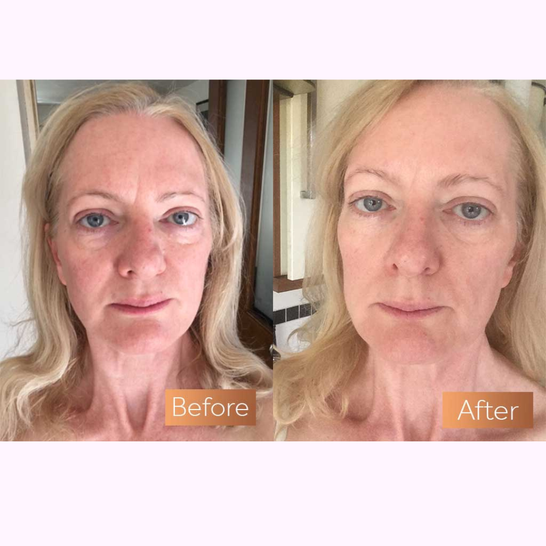 The Menopause Radiance Reset System