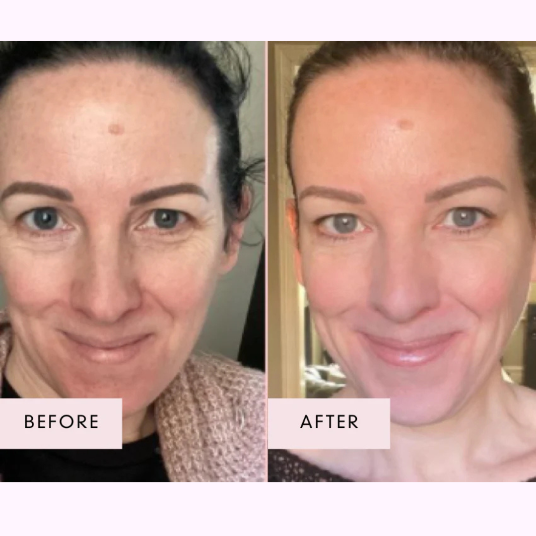 The Menopause Radiance Reset System